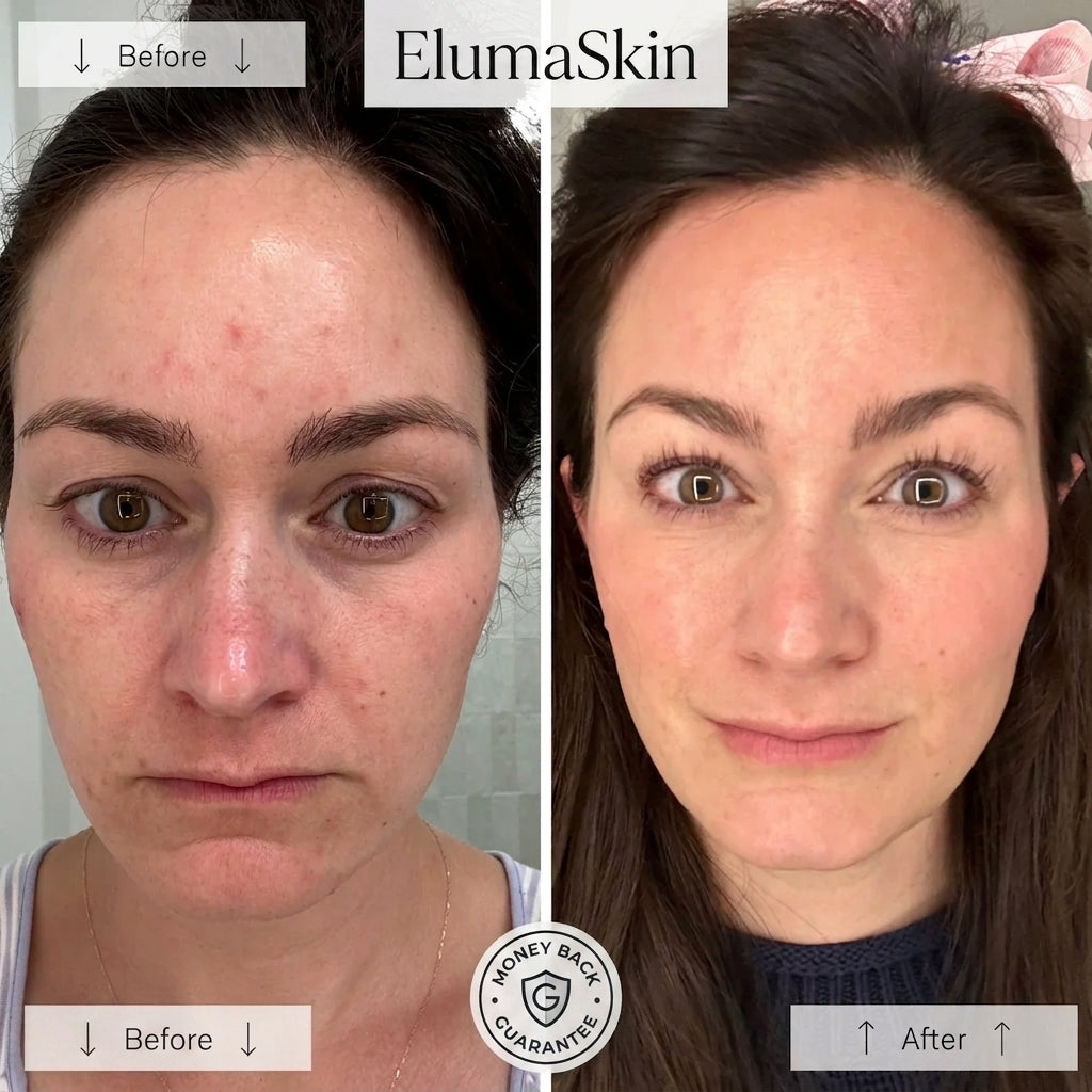 Red Light Therapy Mask | Anti-Aging LED Facial Care