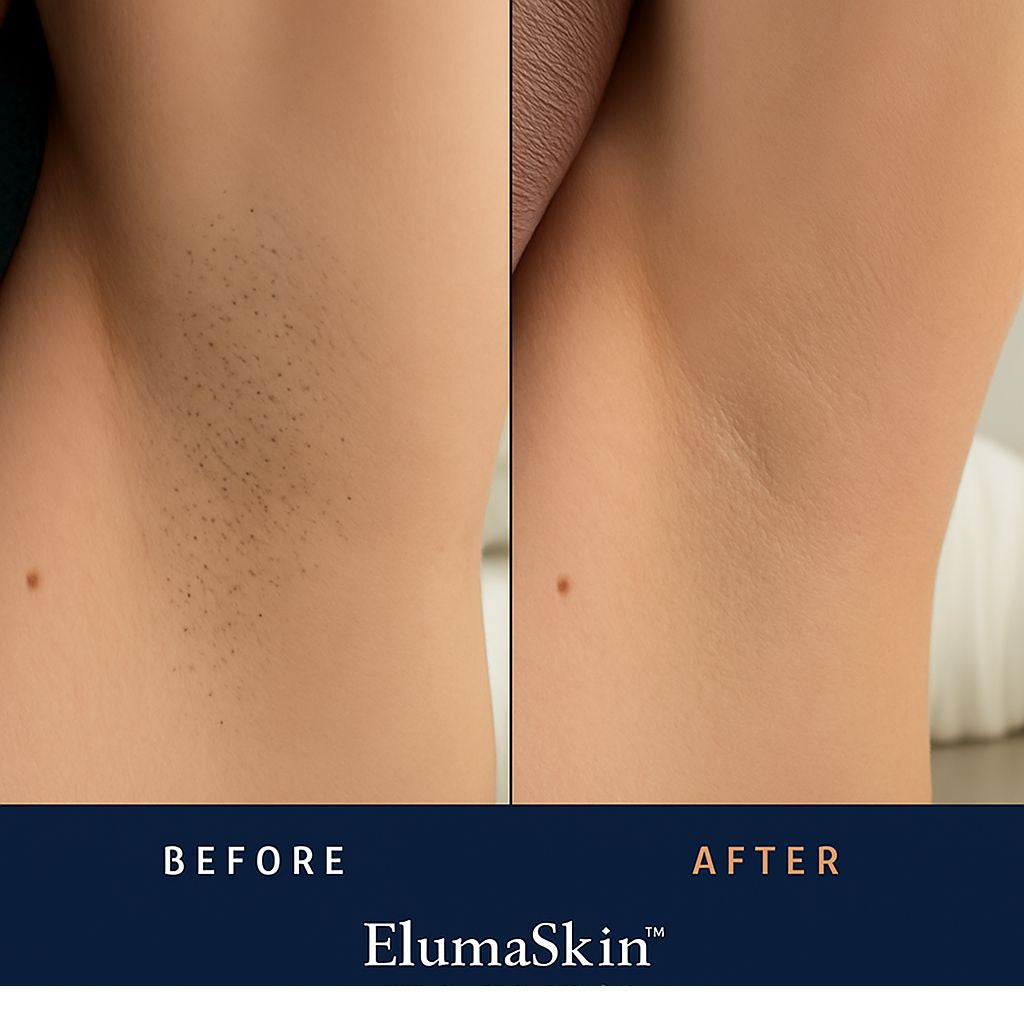 IPL Laser Hair Removal Device for Women – At-Home Permanent