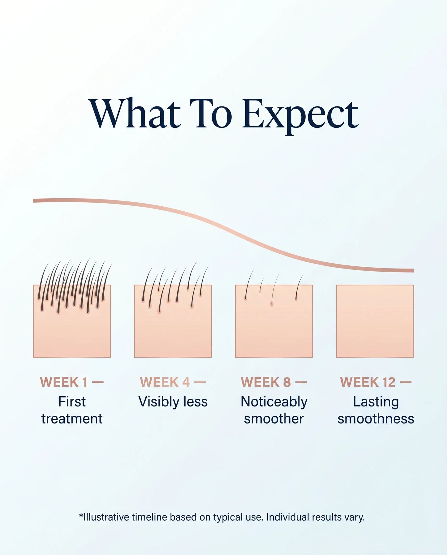 IPL Laser Hair Removal Device for Women – At-Home Permanent