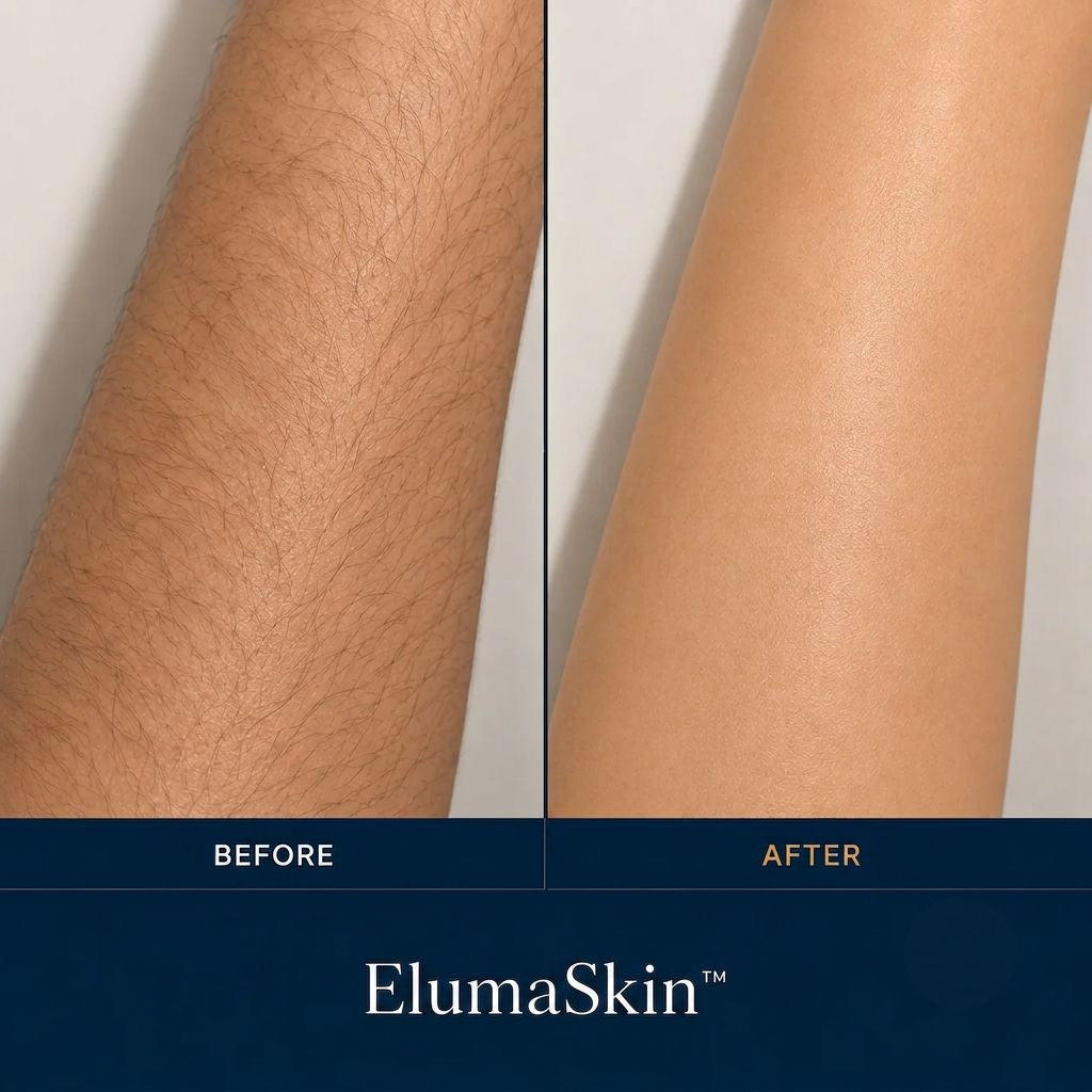 IPL Laser Hair Removal Device for Women – At-Home Permanent